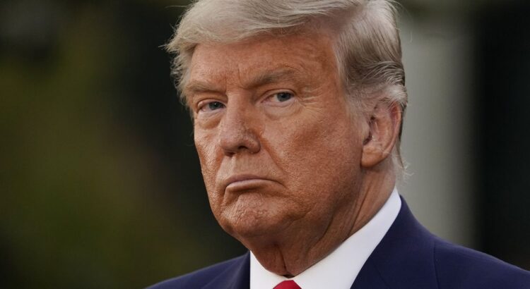 Kaki Bengkak dan Memar, Trump Didiagnosis Alami Masalah Vena Kronis